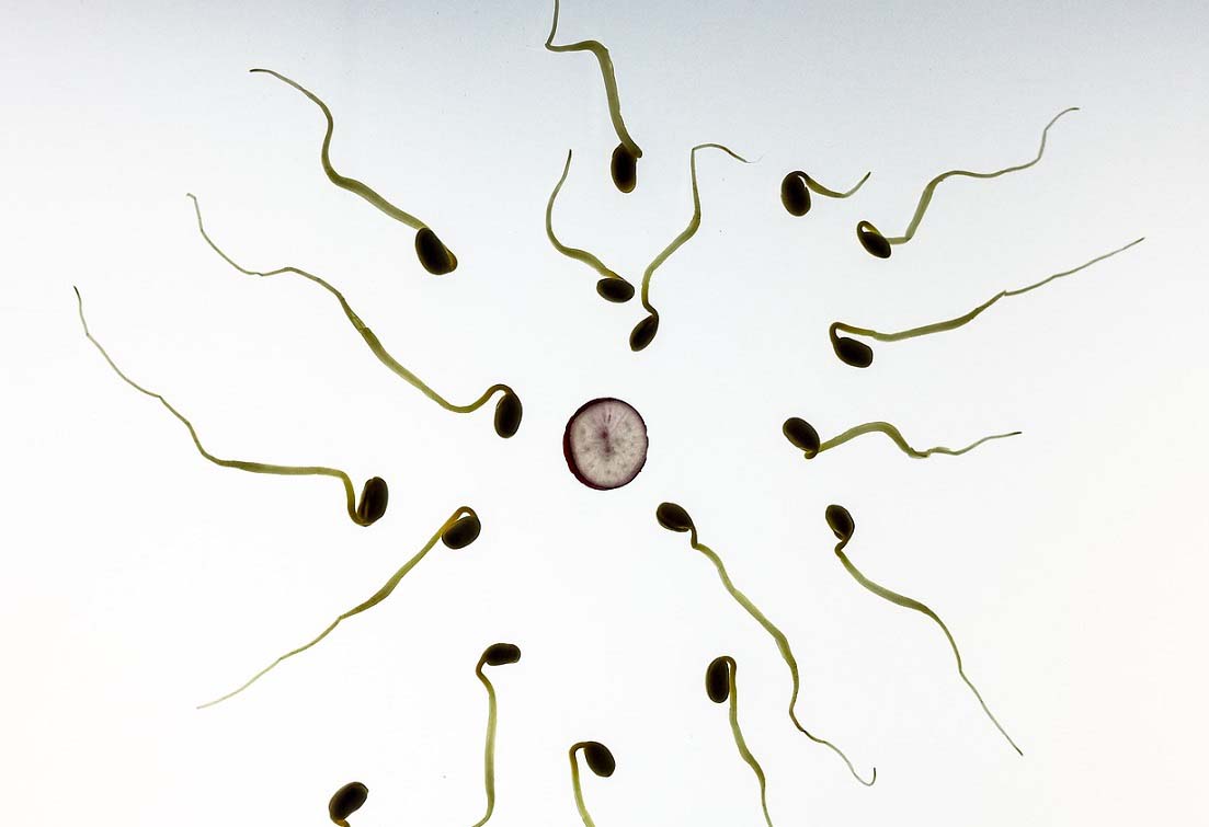 Spermatozoidi%20Pixa