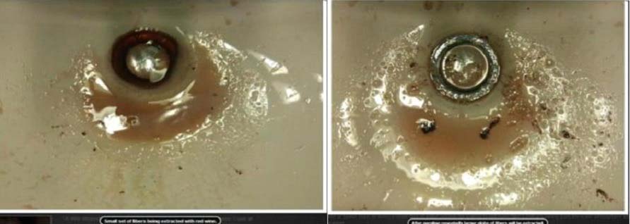 Испљувак у умиваонику (или плиткој пластичној посуди) са видљивим влакнима.